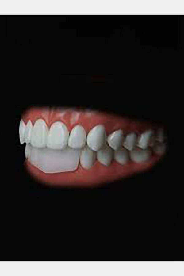 PROTECTOR DENTAL SILVERSTEIN OMNIGUARD (2 PROTECTORES)